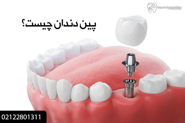 پین دندان چیست